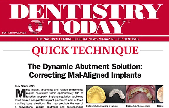 Dentistry Today Article