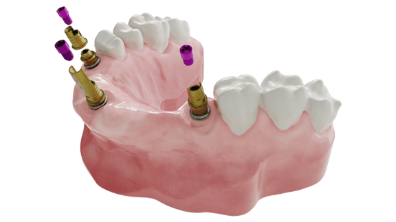 Das multi unit dynamic tibase